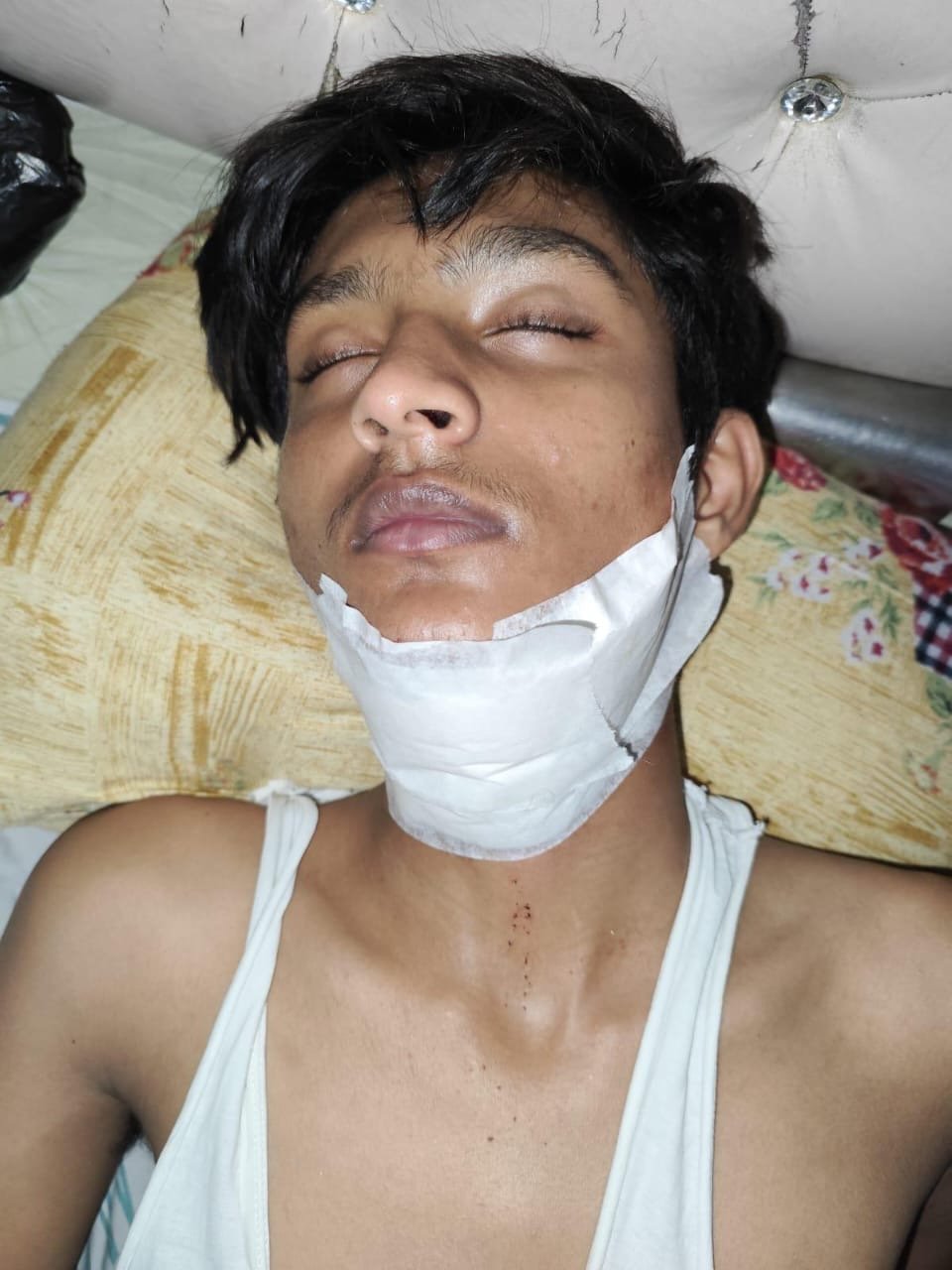 चाइनीज़ मांझे की चपेट में आया युवक, गर्दन पर लगे आधा दर्जन टांके