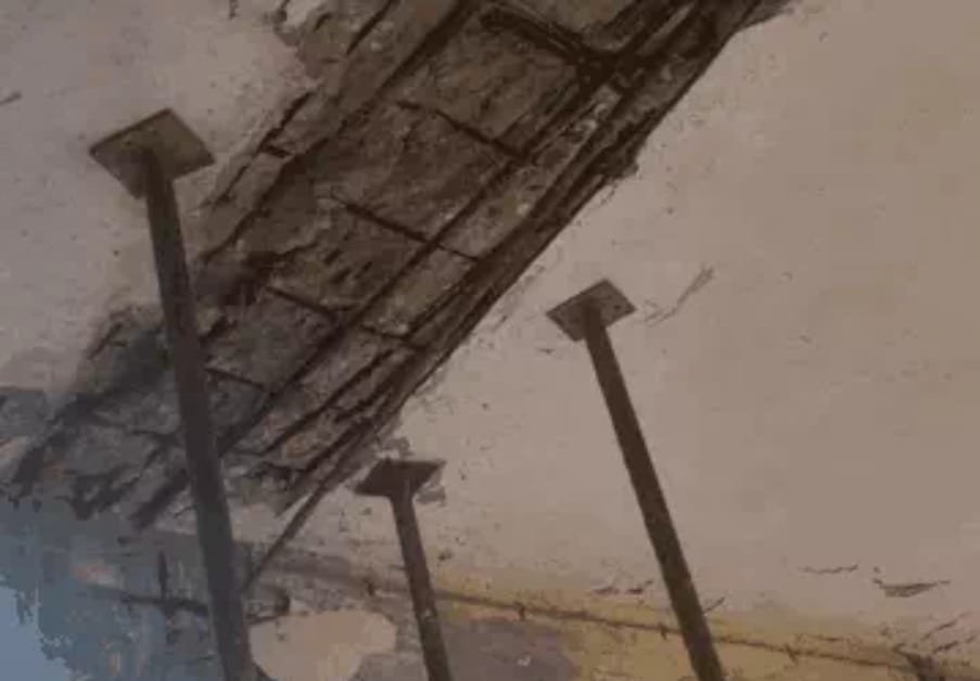 मेडिकल कॉलेज में छत का प्लास्टर गिरा, डॉक्टर गंभीर रूप से घायल