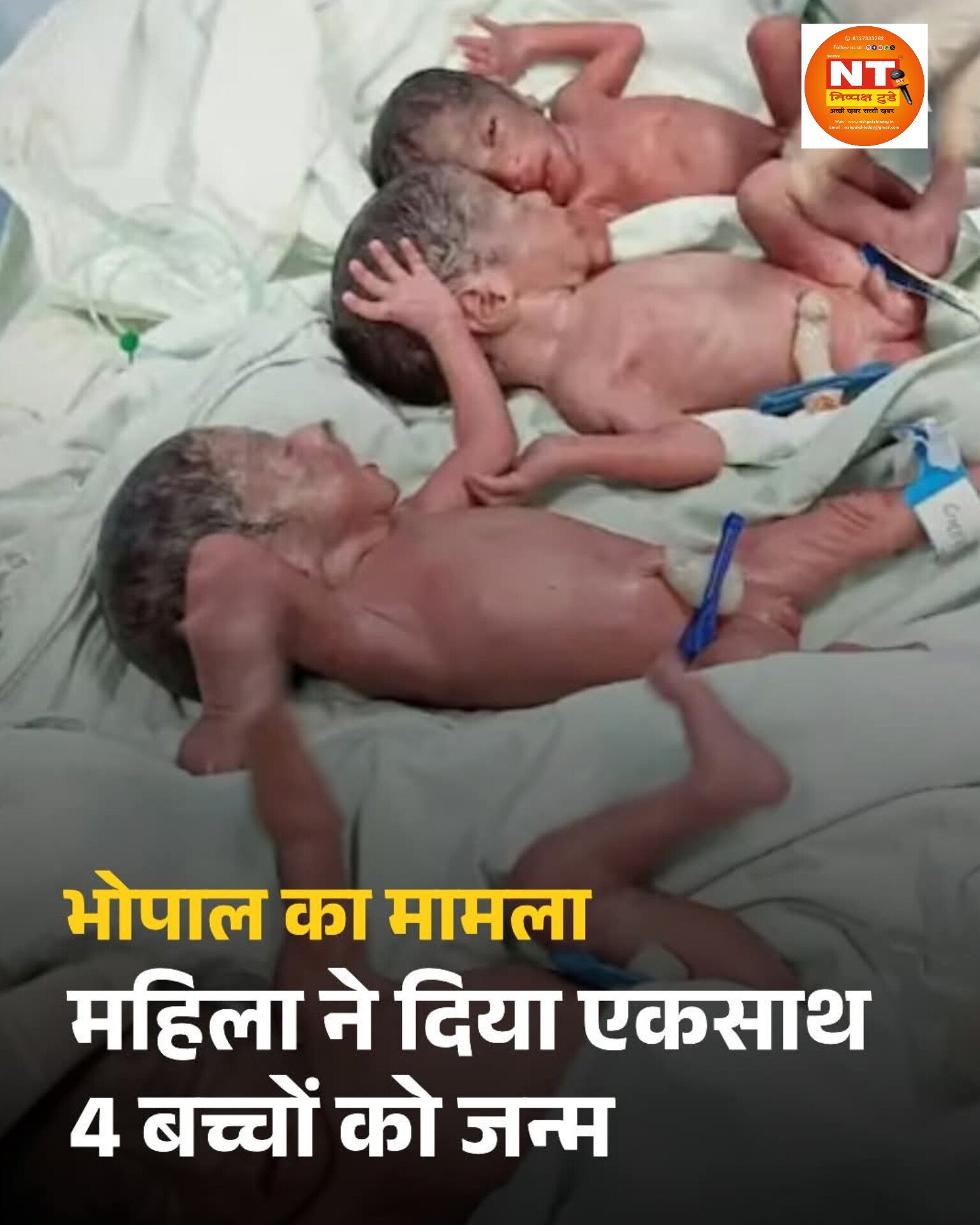 एक महिला ने एक साथ 4 बच्चों को दिया जन्म