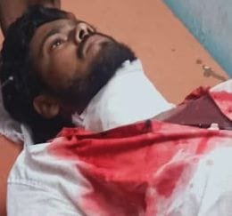 युवक ने दूसरे युवक को चाकू मारकर किया लहूलुहान