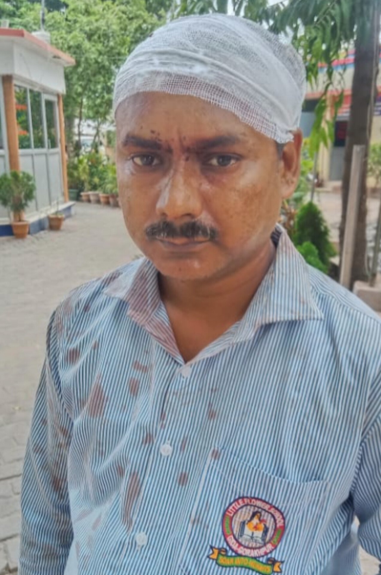 पेड़ की डाल काटने को लेकर दंपत्ति ने ईट से मारकर सिर फोड़ा